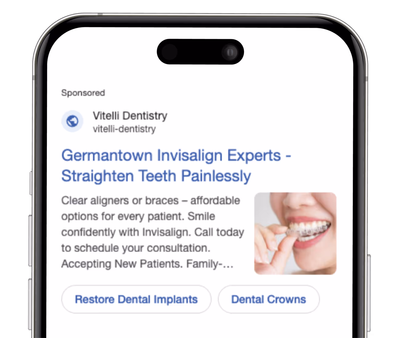 Invisalign and clear aligner Google Ads campaign for adult patients